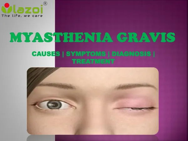 Myasthenia Gravis: Symptoms, Causes, diagnosis and treatment.