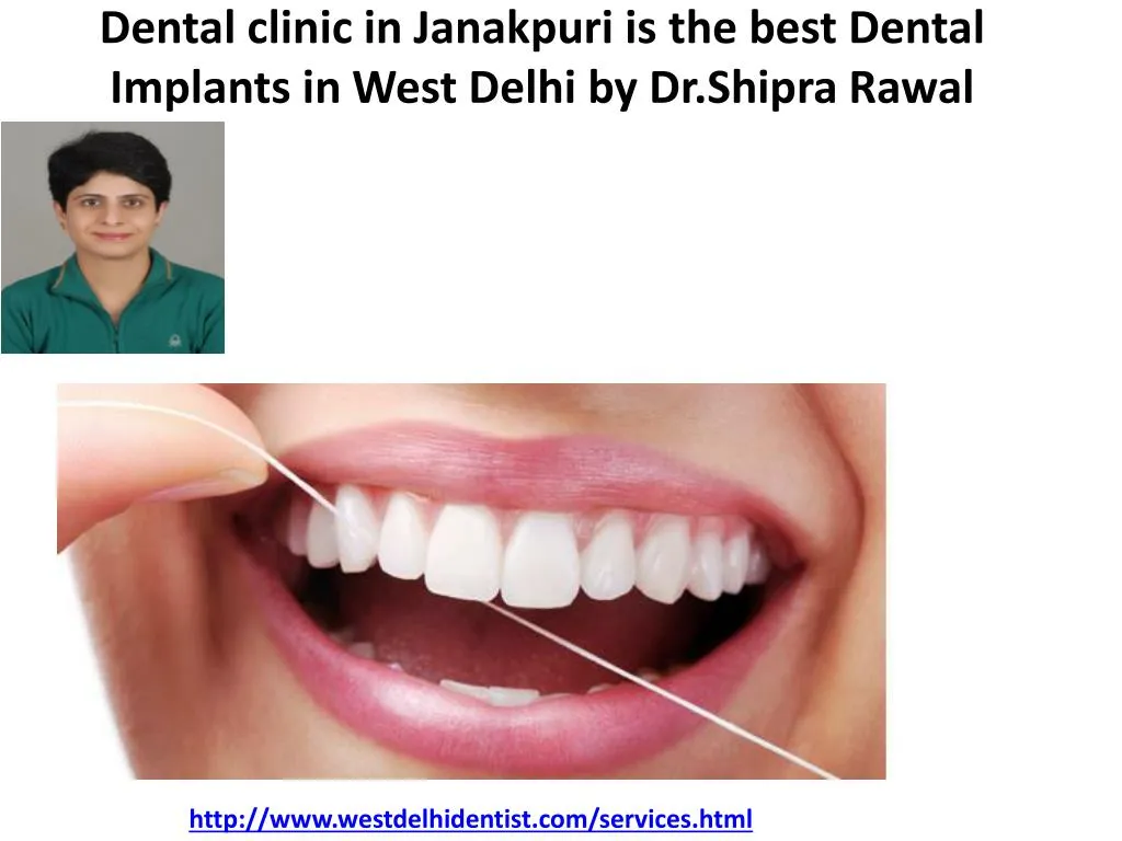 dental clinic in janakpuri is the best dental implants in west delhi by dr shipra rawal