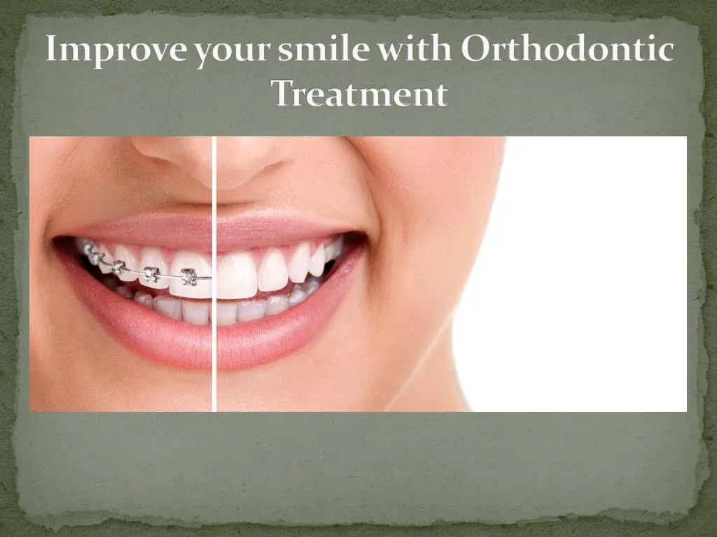 improve your smile with orthodontic treatment