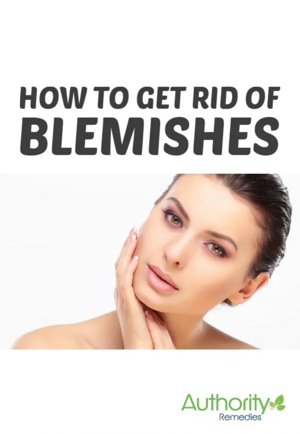 Top Home Remedies For Blemishes