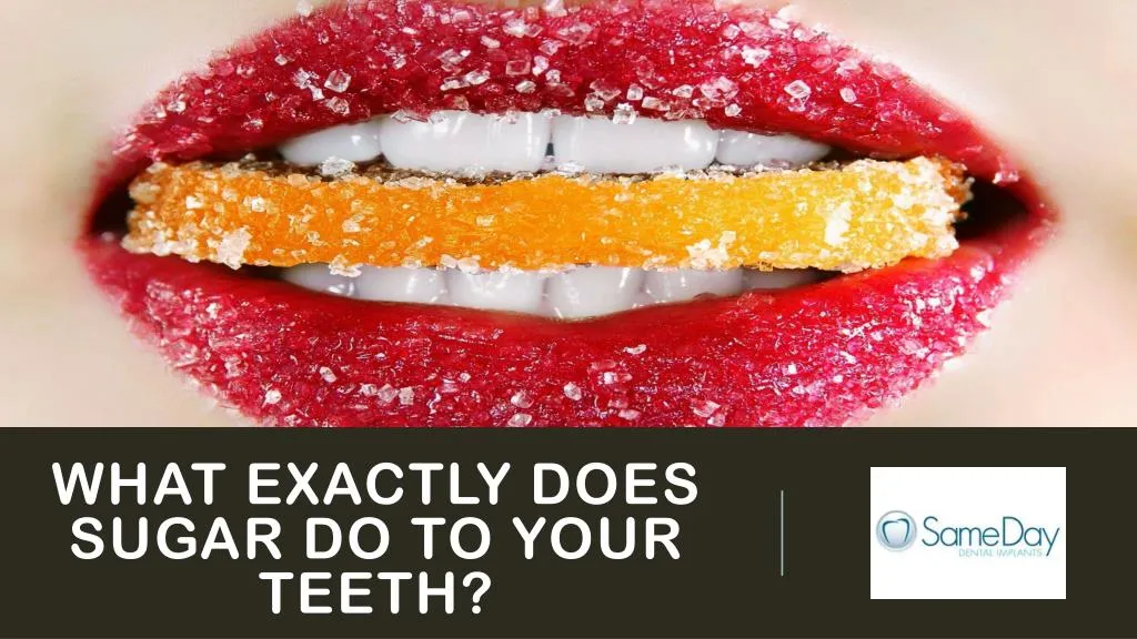 what exactly does sugar do to your teeth