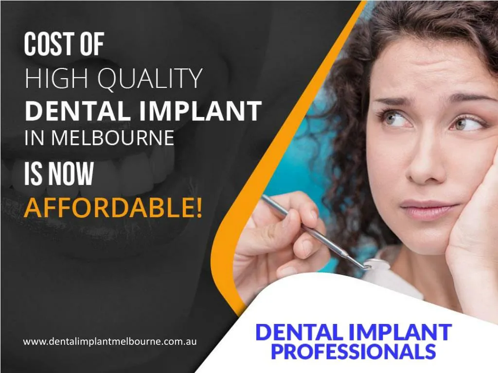 cost of high quality dental implant in melbourne is now affordable