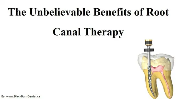 The Unbelievable Benefits of Root Canal Therapy