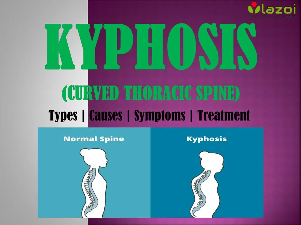 kyphosis curved thoracic spine
