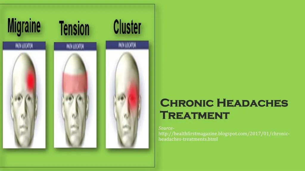 chronic headaches treatment