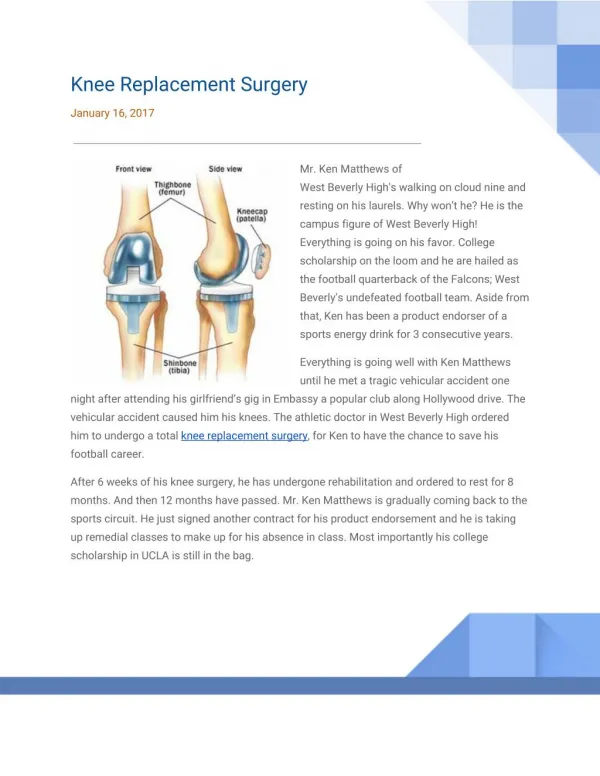 Patients Comment on Knee Replacement Surgery