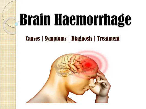 Brain Haemorrhage: Symptoms, causes, diagnosis and treatment