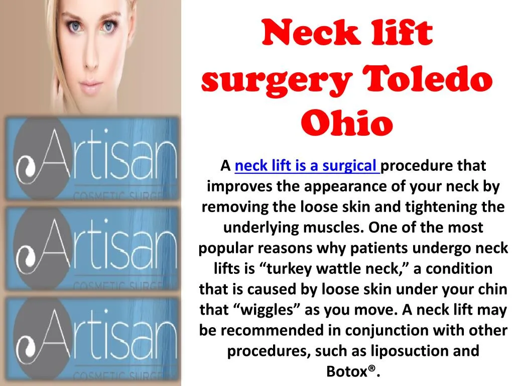 neck lift surgery toledo ohio