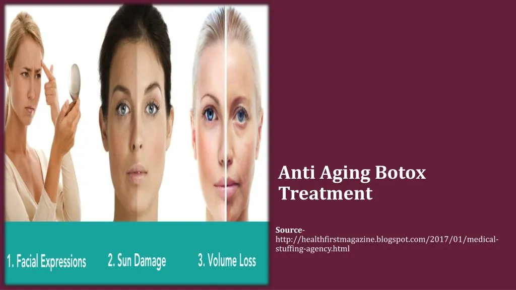 anti aging botox treatment