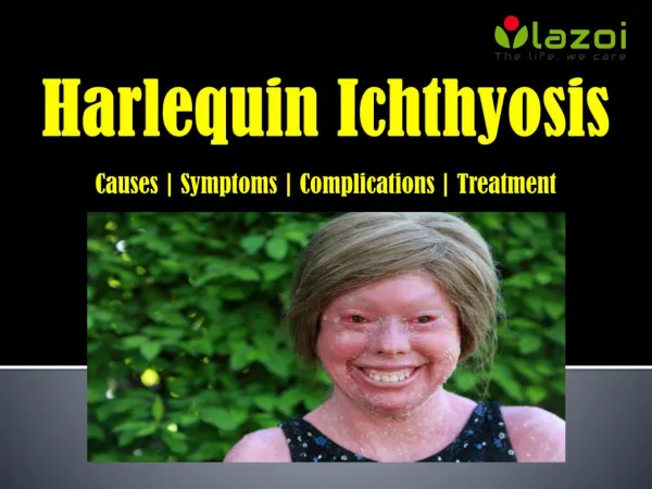 Harlequin Ichthyosis: Causes, symptoms, complications and treatment.