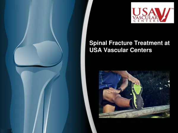 Spinal Fracture Treatment in California at USA Vascular Centers
