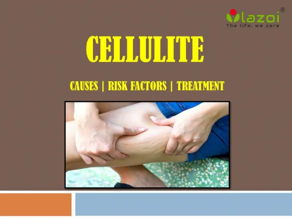Cellulite: Causes, risk factors and treatment