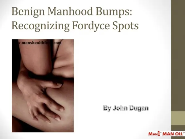 Benign Manhood Bumps: Recognizing Fordyce Spots