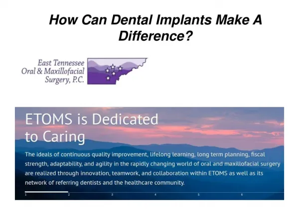 How Can Dental Implants Make A Difference?
