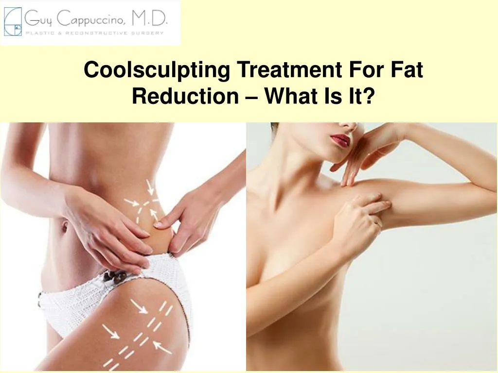coolsculpting treatment for fat reduction what is it