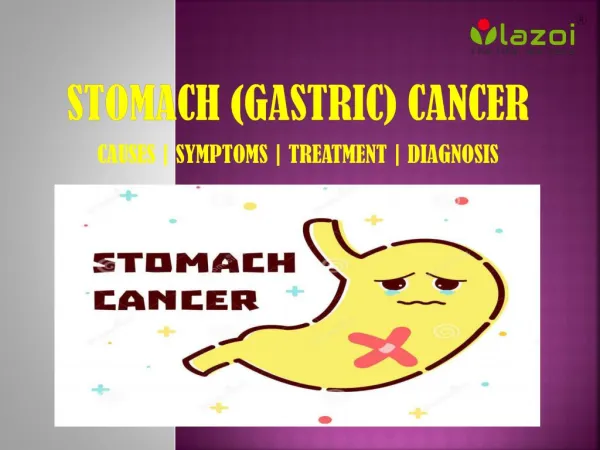 Stomach (Gastric) Cancer: Causes, symptoms, diagnosis, and treatment.