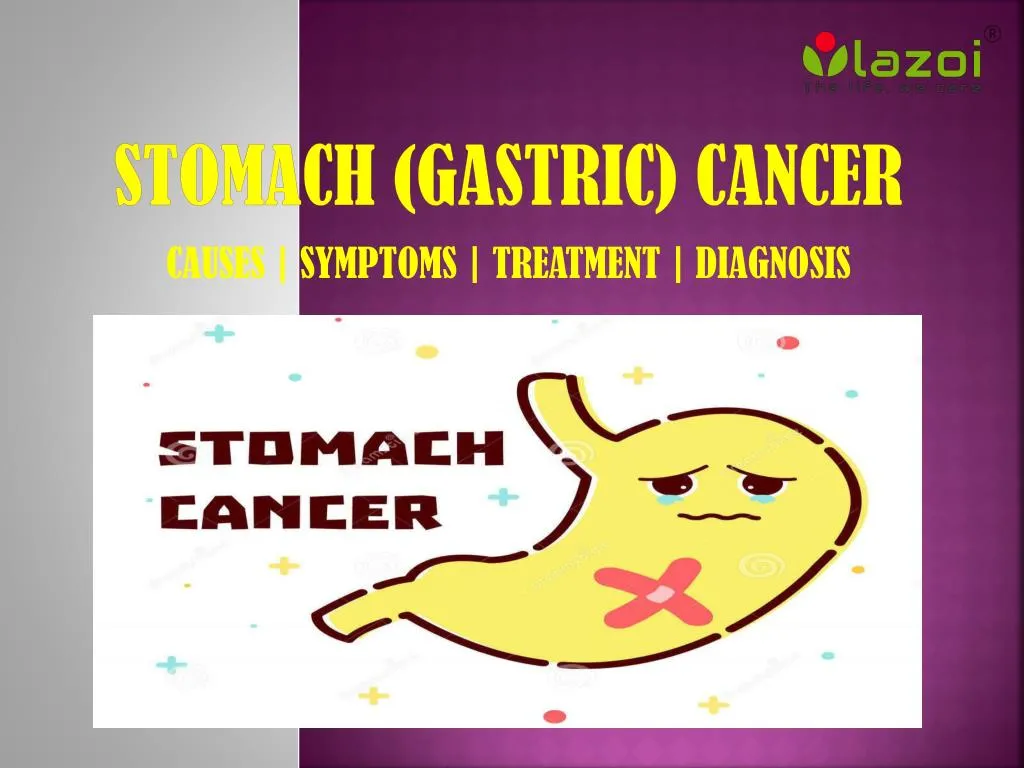 stomach gastric cancer