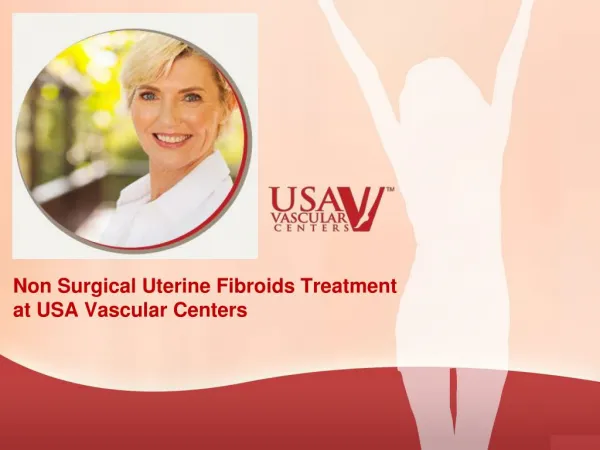 Non Surgical Uterine Fibroids Treatment - USA Vascular Centers