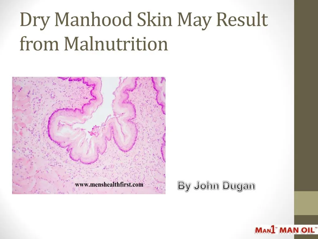 dry manhood skin may result from malnutrition