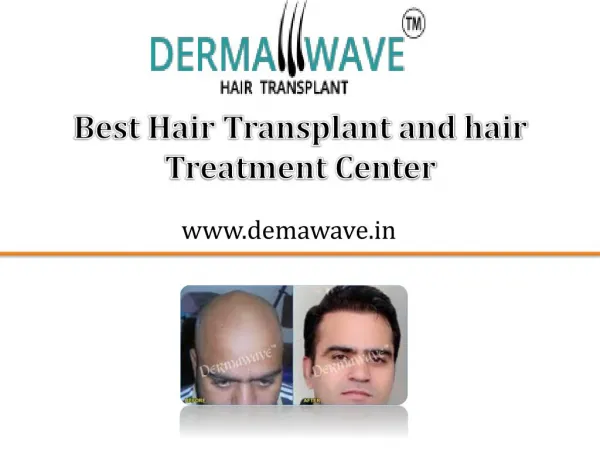 Hair transplant and Hair treatment - Dermawave