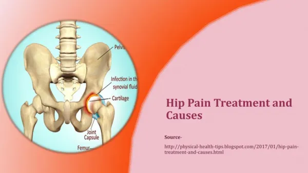 Hip Pain Treatment and Causes