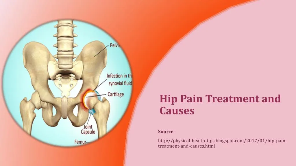 hip pain treatment and causes