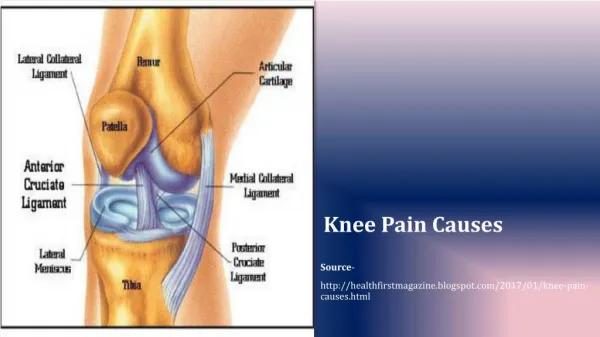 Knee Pain Causes