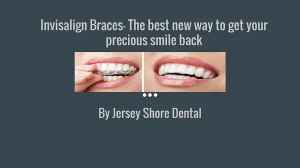 Invisalign Braces- The best new way to get your precious smile back