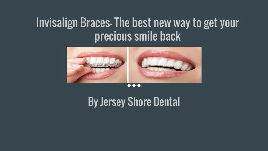 invisalign braces the best new way to get your precious smile back