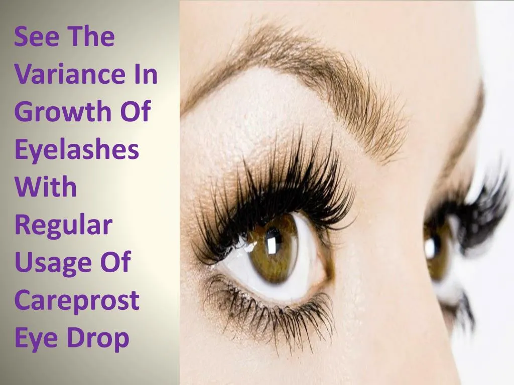 see the variance in growth of eyelashes with regular usage of careprost eye drop