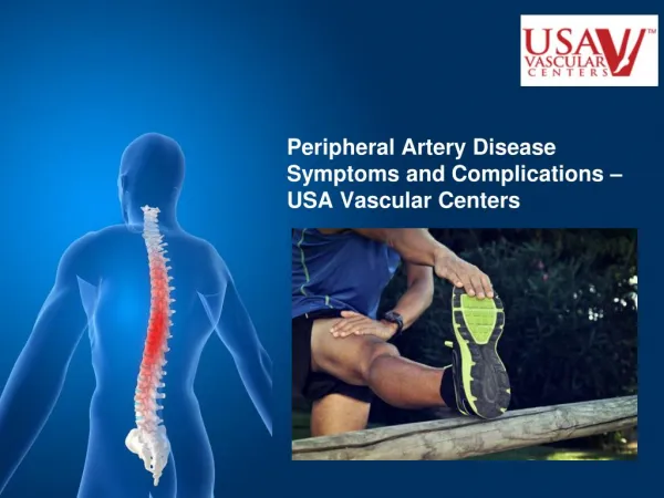 PAD Symptoms & Complications - USA Vascular Centers