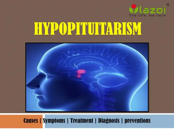 Hypopituitarism: An uncommon health condition.