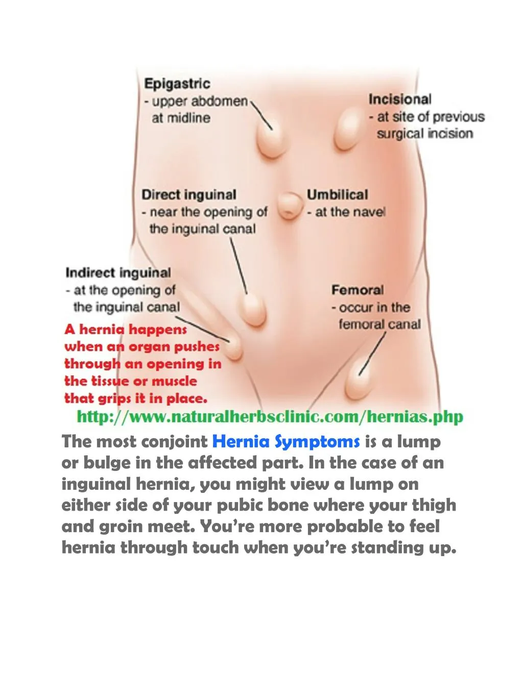 the most conjoint hernia symptoms is a lump