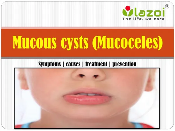 Mucous cysts (Mucoceles): Symptoms, causes, treatment and preventions.