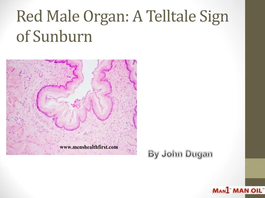 red male organ a telltale sign of sunburn