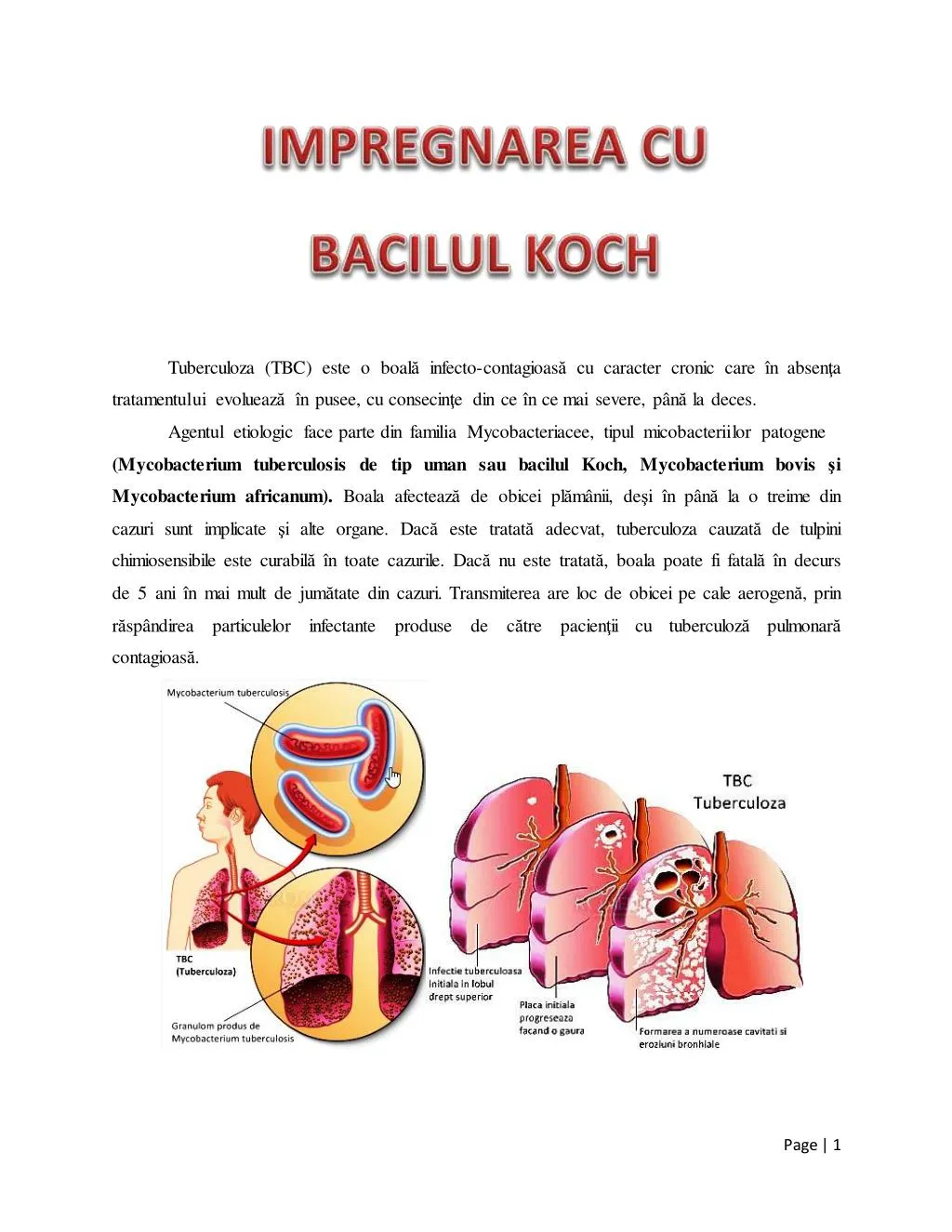 tuberculoza tbc este o boal infecto contagioas
