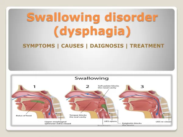 Swallowing disorder (dysphagia) in children- Causes, Symptoms, Diagnosis and Treatment