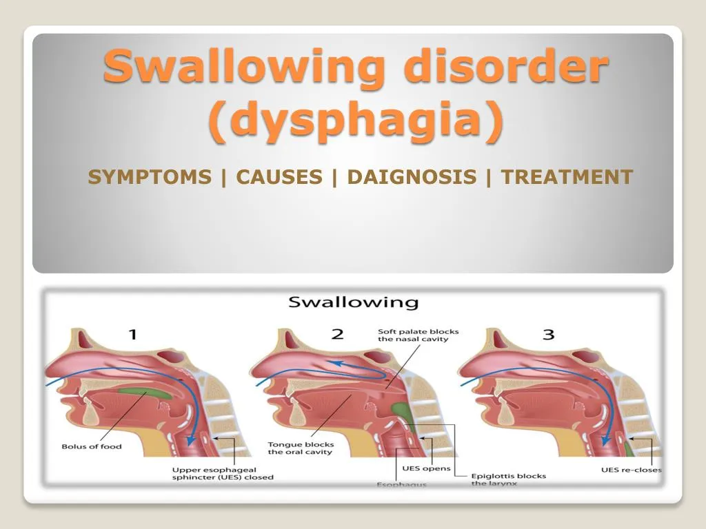 swallowing disorder dysphagia
