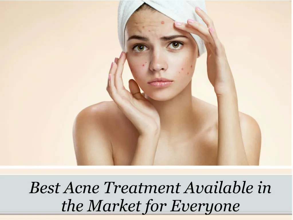 best acne treatment available in the market