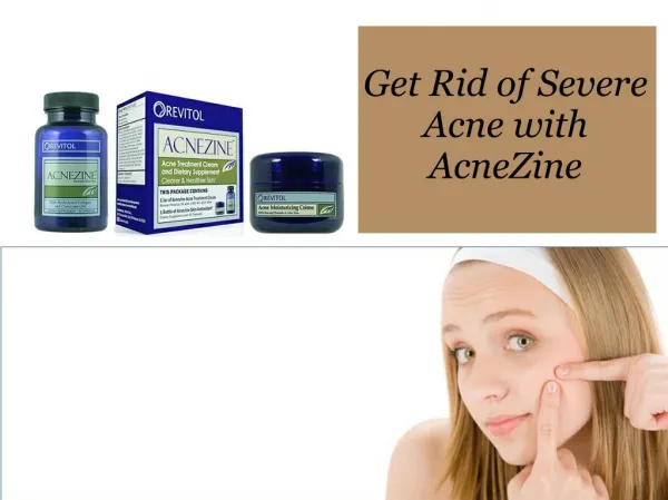 Get rid of severe acne with AcneZine