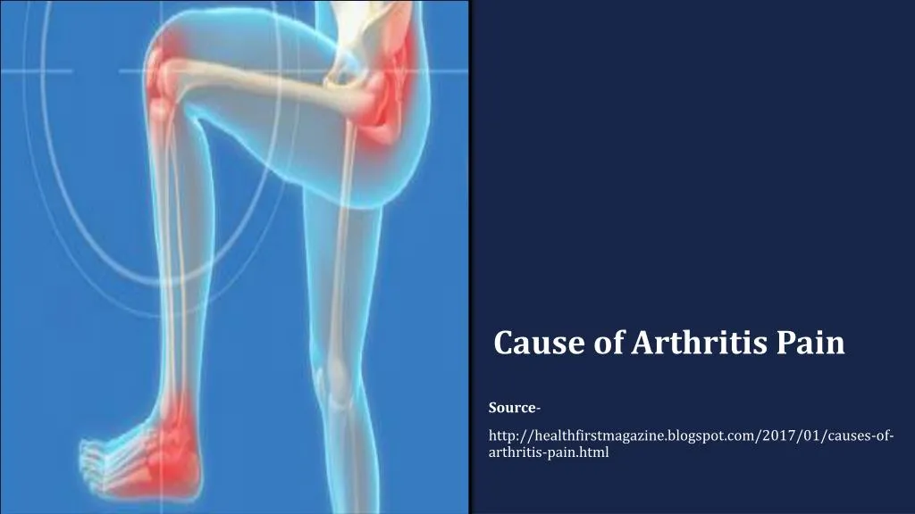 cause of arthritis pain