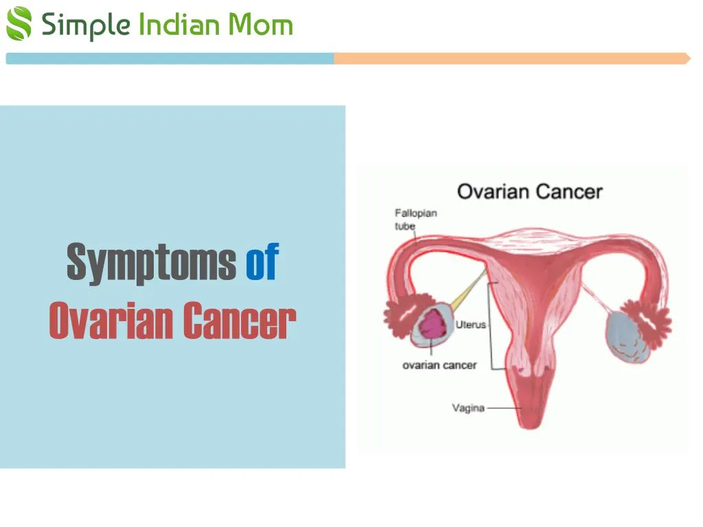 symptoms of ovarian cancer