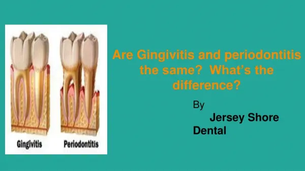 Are Gingivitis and Periodontitis the same? What’s the difference?