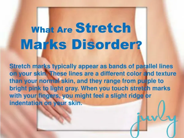 Laser Stretch Marks Removal Treatment | Stretch Mark Therapy