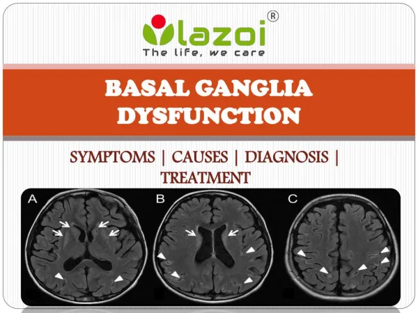 Basal ganglia disease : causes, symptoms, treatment and diagnosis
