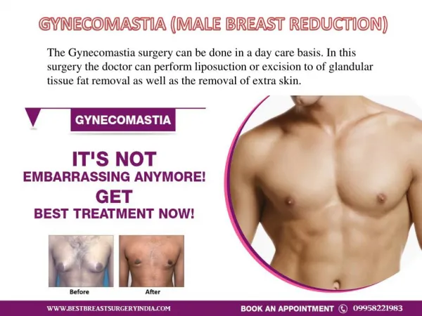 Male Breast Reduction : Gynecomastia Surgery in Delhi, INDIA