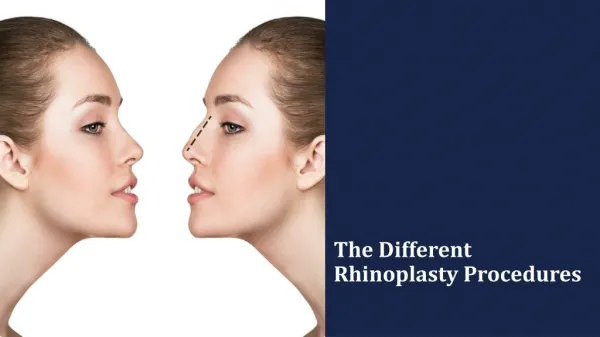 The Different Rhinoplasty Procedures