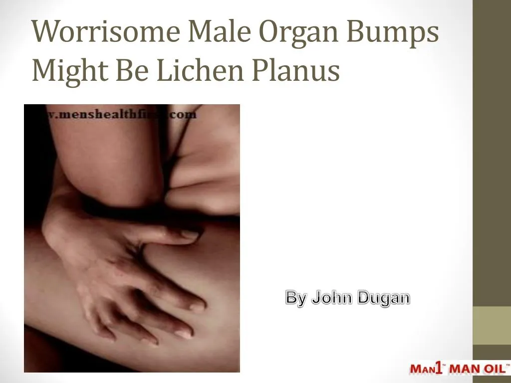 worrisome male organ bumps might be lichen planus