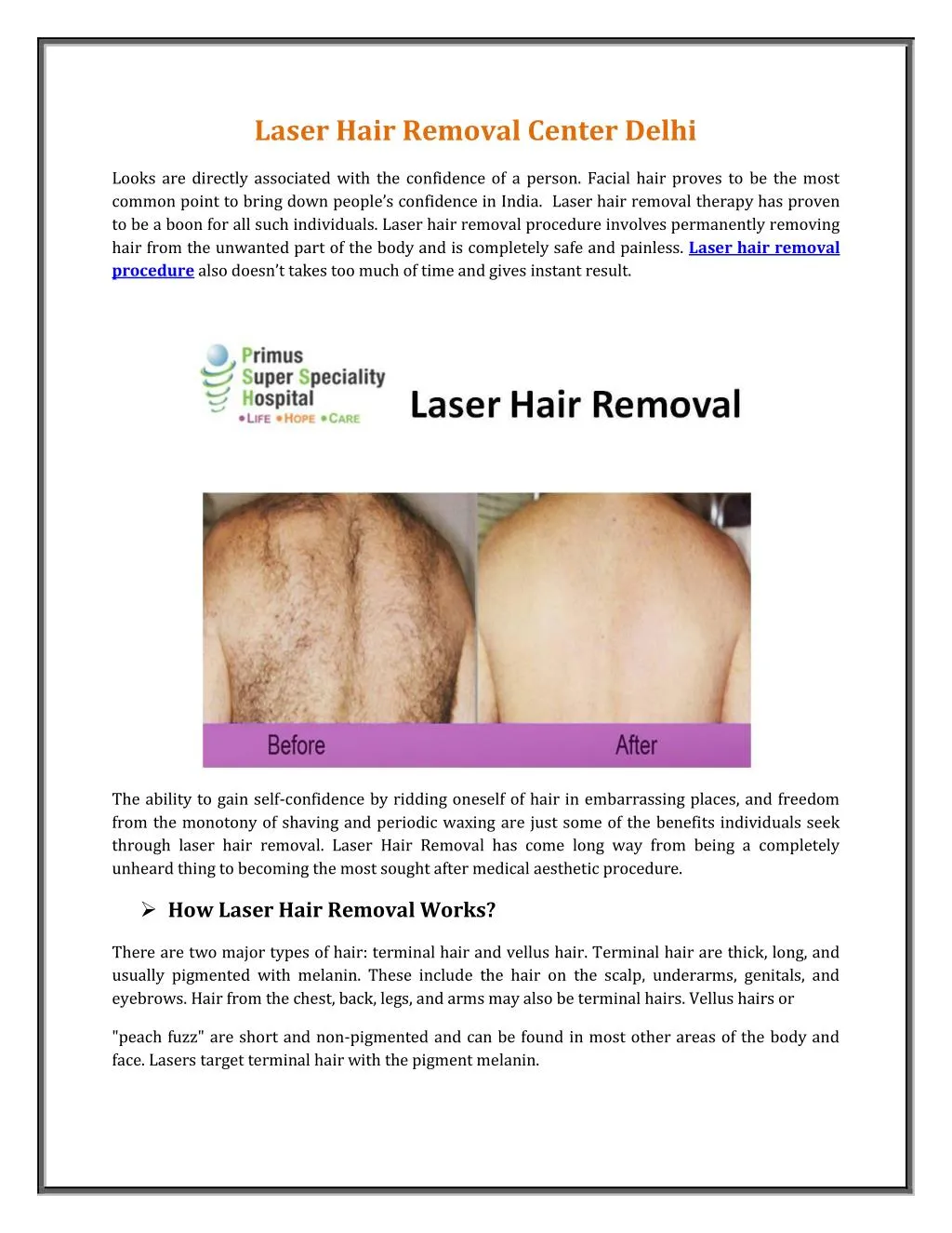 laser hair removal center delhi