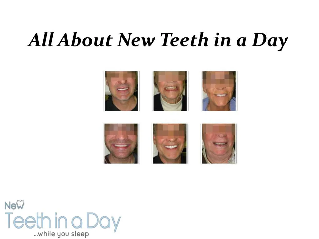 all about new teeth in a day